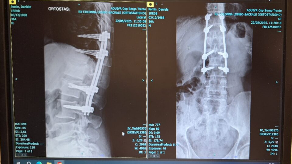 All’ospedale con la bici